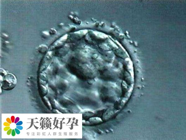 试管婴儿优胚的成功率比较高