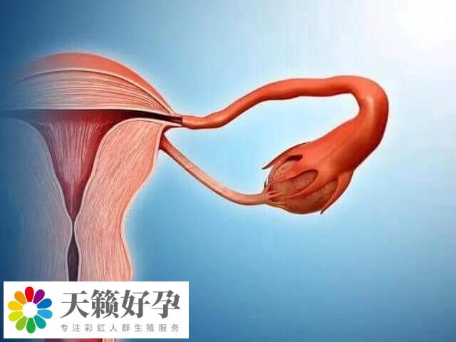 大的卵巢囊肿要先进行治疗