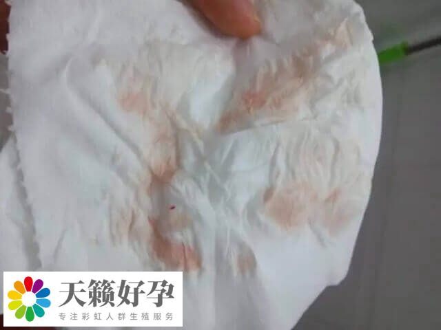 试管移植后出血要注意观察