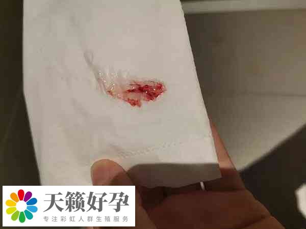 试管移植后出血是着床出血