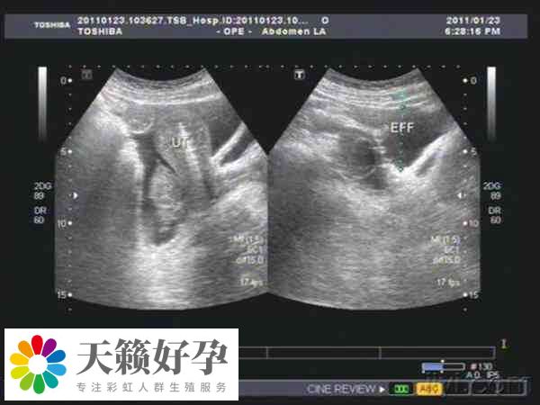 促排数量多有助于提高成功率
