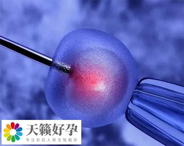 人工授精失败转试管要做手术