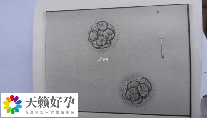 移植冻胚和自然怀孕测出时间不一样