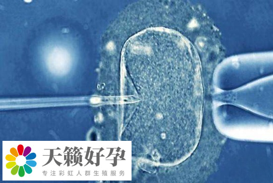 高龄女性可以去泰国做试管