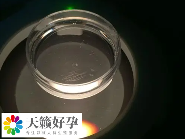 供精不是必须做显微镜检查