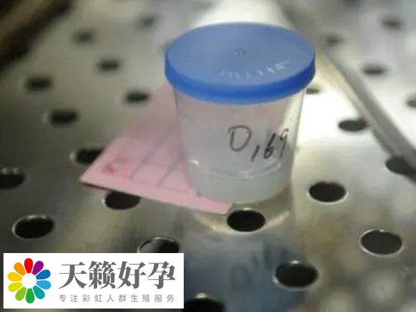 供精不是必须要血型一致