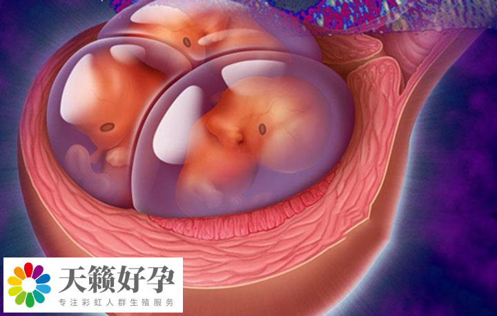 植入多个胚胎可能会导致多胎妊娠
