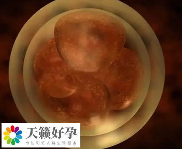 肥胖会影响卵子质量