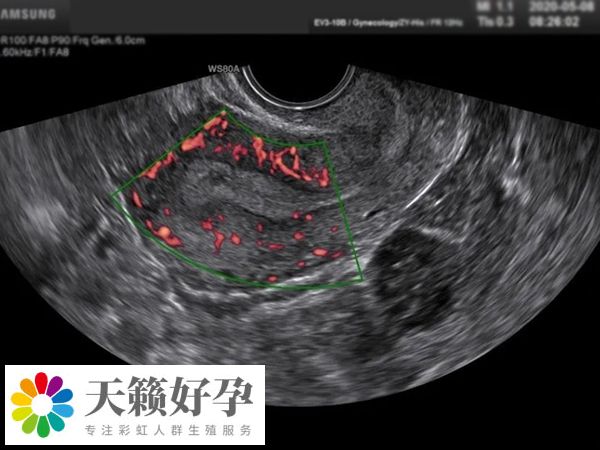 男性需要进行睾丸超声检查