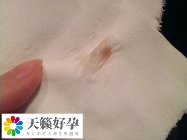 试管移植后胸胀疼可能是怀孕了