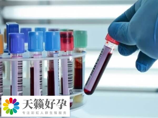 试管移植后要抽血查是否怀孕了