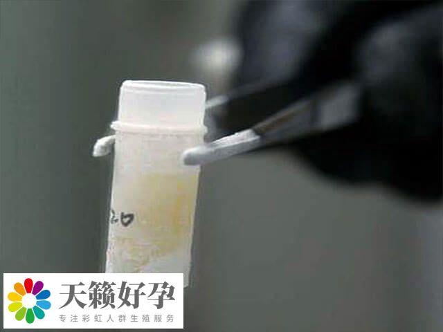 取精是在取精室通过手淫取精