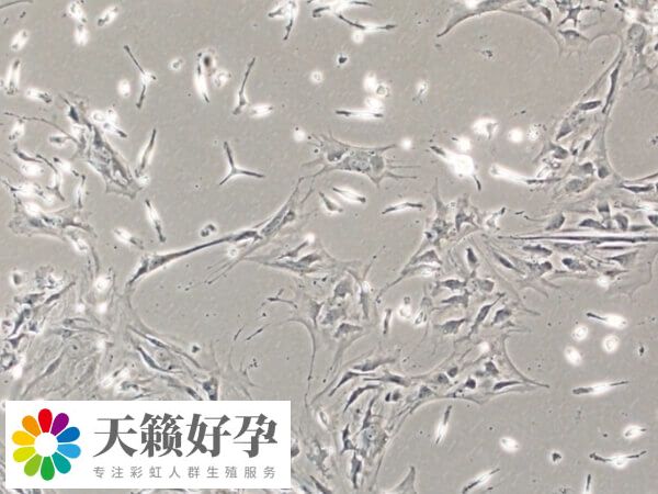 女女同性恋能用骨髓干细胞生孩子吗？成功率高不高？