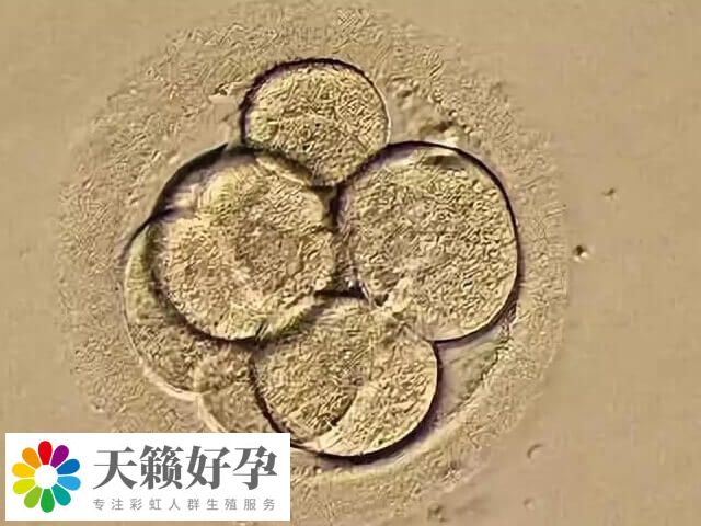 如何改善一卵多精的情况