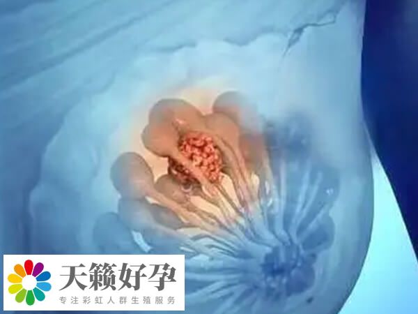 乳腺纤维瘤做试管会不会影响加重