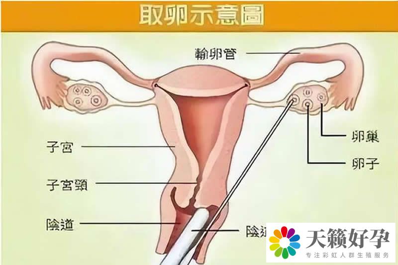 天锋试管 天锋试管